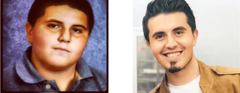 Before and after image of Raul's weight loss transformation